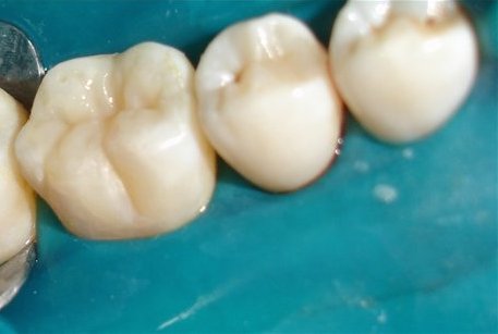 стоматология красноярск