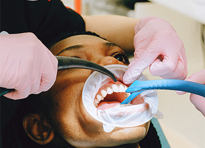 Больно ли делать чистку зубов у стоматолога?