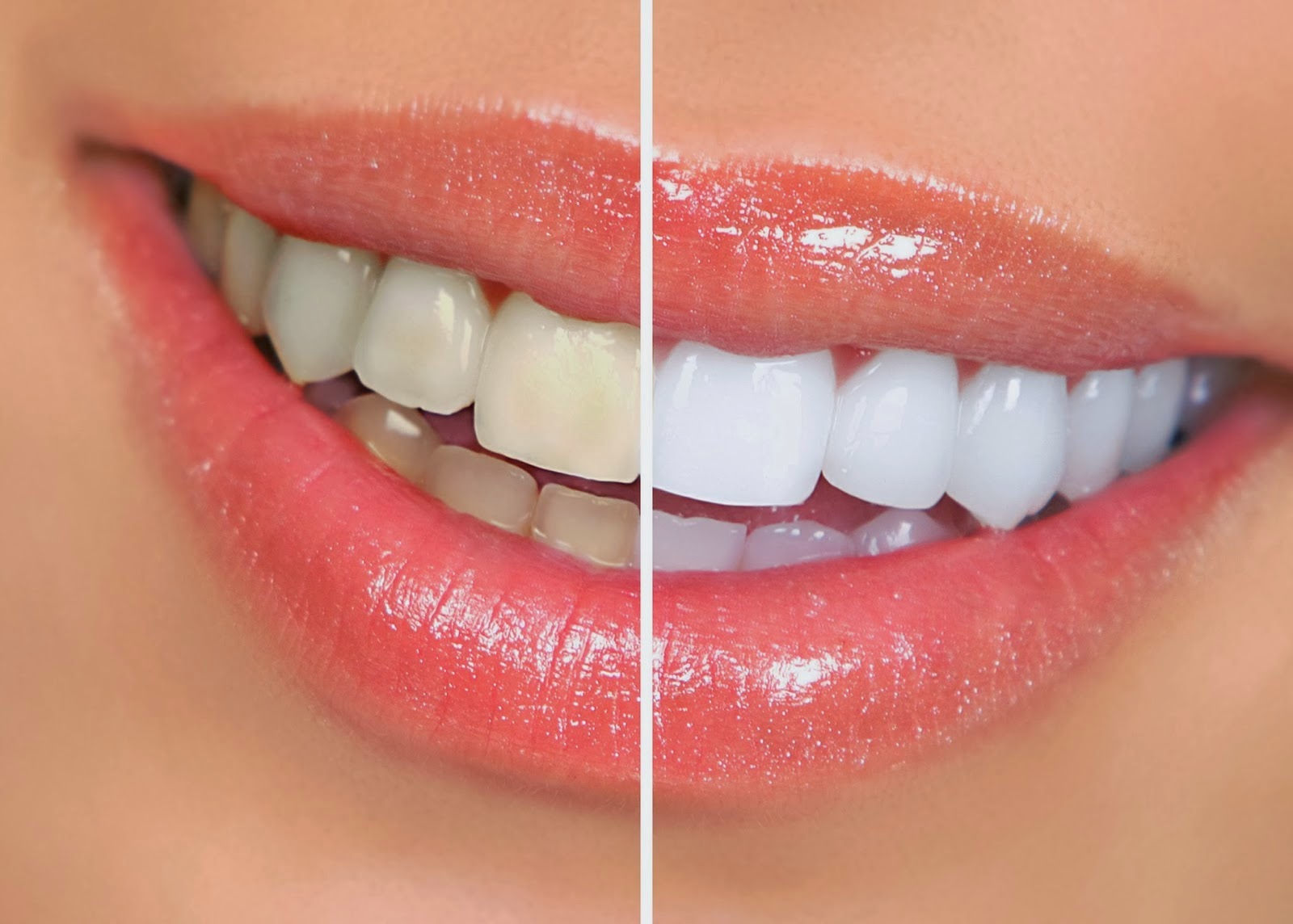 Почему Ваши зубы желтеют